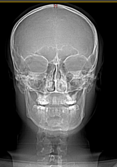 10.03.2023_19.18.47_REC